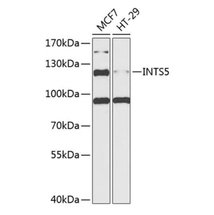 Western Blot - Anti-INTS5 Antibody (A88033) - Antibodies.com