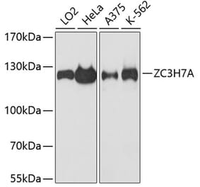 Western Blot - Anti-ZC3H7A Antibody (A88034) - Antibodies.com