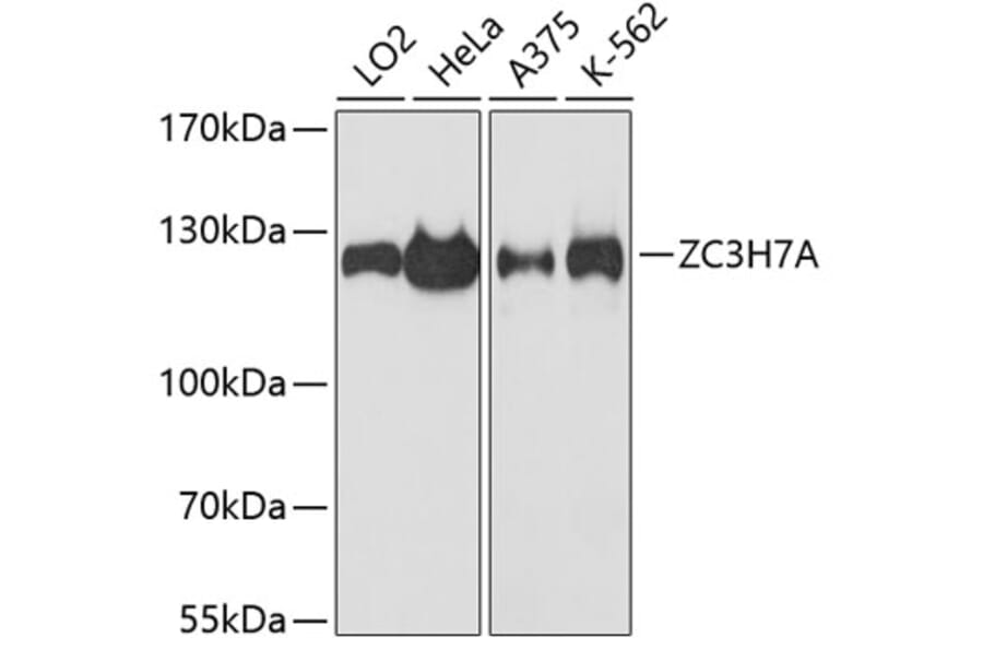 Western Blot - Anti-ZC3H7A Antibody (A88034) - Antibodies.com