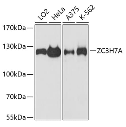 Western Blot - Anti-ZC3H7A Antibody (A88034) - Antibodies.com
