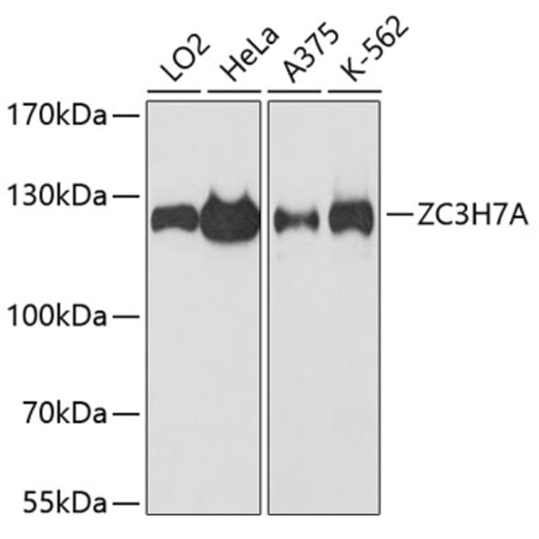 Western Blot - Anti-ZC3H7A Antibody (A88034) - Antibodies.com