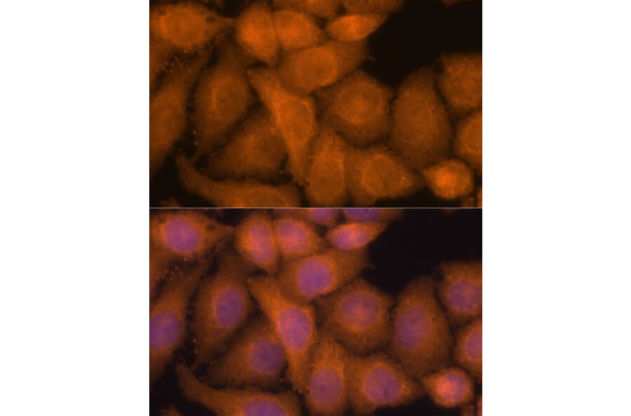 Immunofluorescence - Anti-ZC3H7A Antibody (A88034) - Antibodies.com