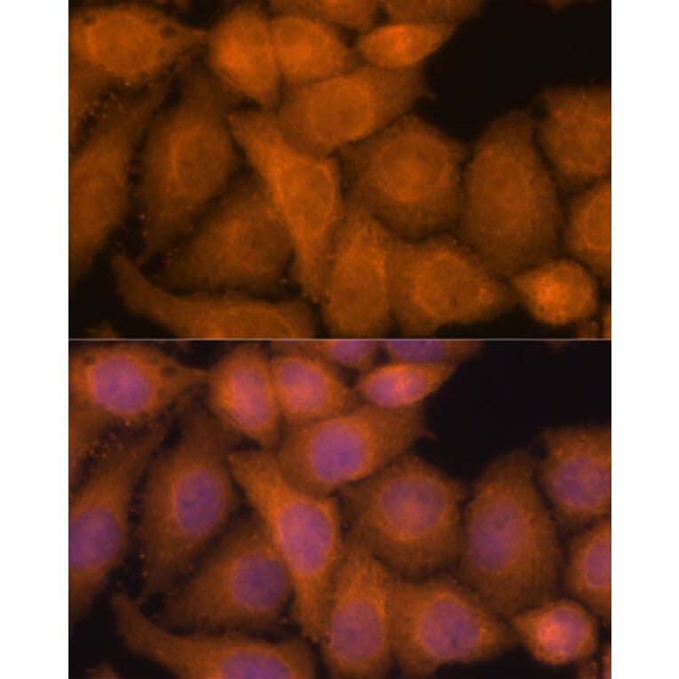 Immunofluorescence - Anti-ZC3H7A Antibody (A88034) - Antibodies.com
