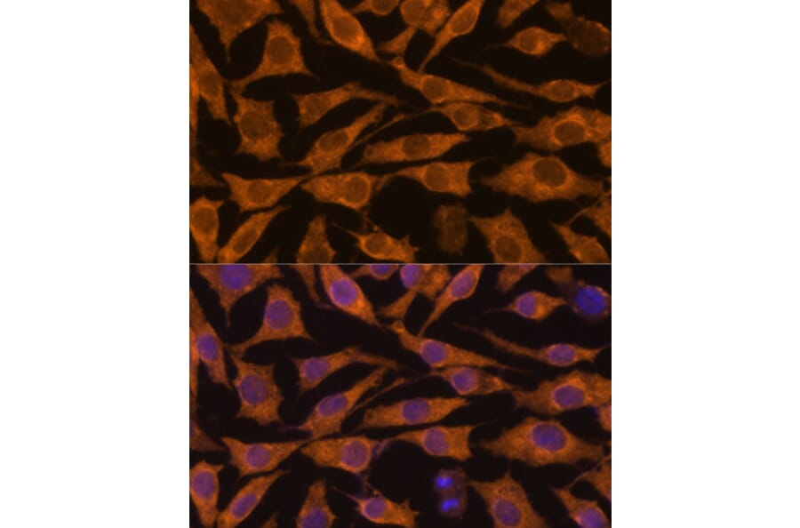 Immunofluorescence - Anti-ZC3H7A Antibody (A88034) - Antibodies.com