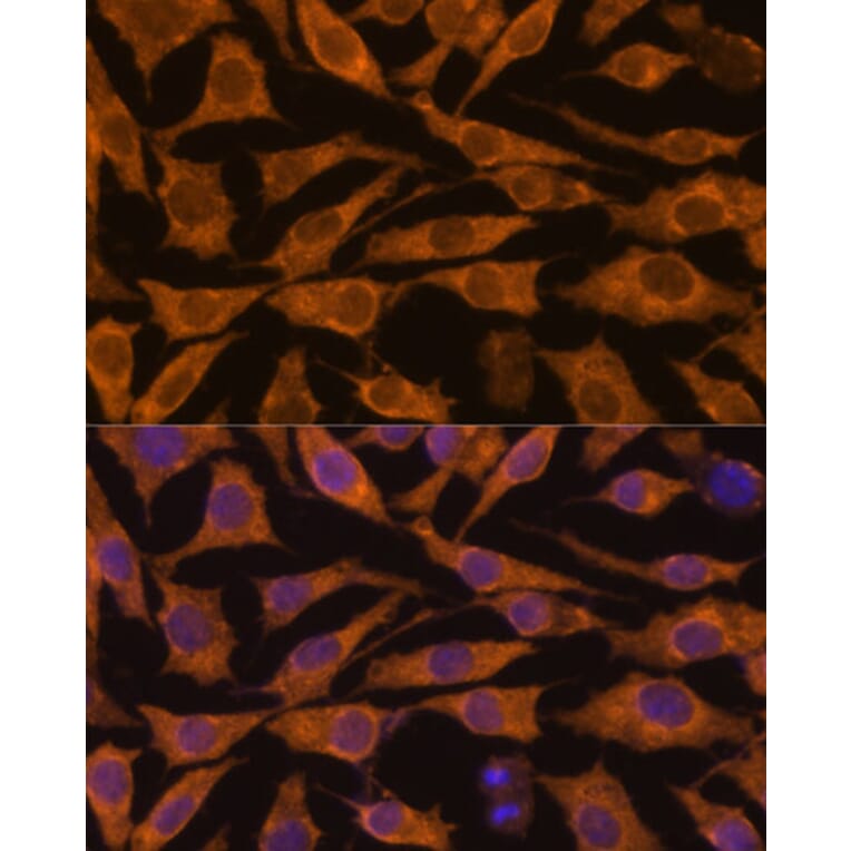 Immunofluorescence - Anti-ZC3H7A Antibody (A88034) - Antibodies.com