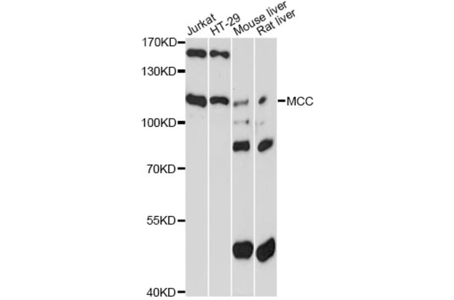Western Blot - Anti-MCC Antibody (A13857) - Antibodies.com