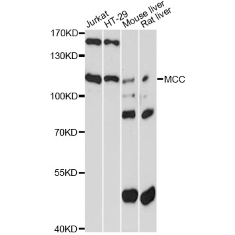 Western Blot - Anti-MCC Antibody (A13857) - Antibodies.com