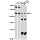 Western Blot - Anti-MCC Antibody (A13857) - Antibodies.com