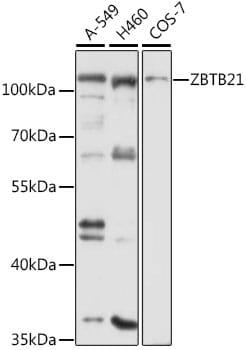 Western blot analysis of extracts of various cell lines, using Anti-ZBTB21 Antibody (A12793) at 1:3000 dilution.
Secondary antibody: Goat Anti-Rabbit IgG (H+L) (HRP) (AS014) at 1:10,000 dilution.
Lysates / proteins: 25µg per lane.
Blocking buffer: 3% non-fat dry milk in TBST.
Detection: ECL Basic Kit (RM00020).
Exposure time: 30s.
