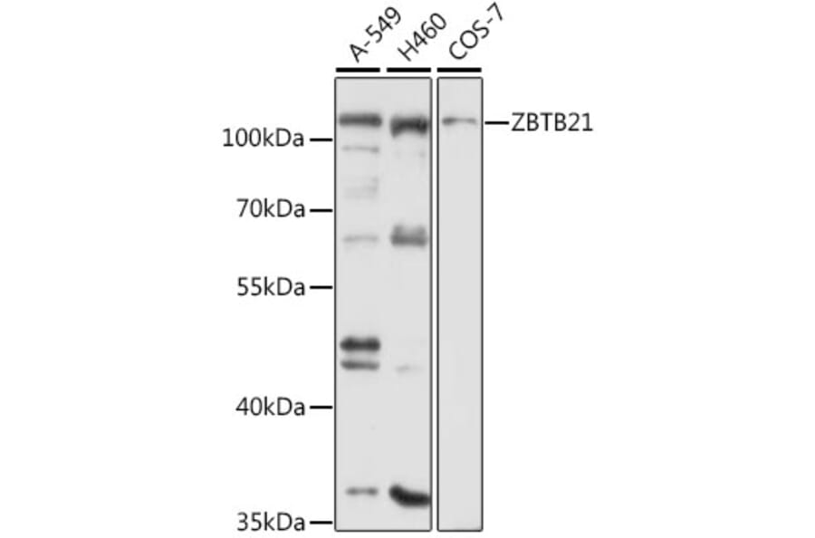 Western Blot - Anti-ZBTB21 Antibody (A12793) - Antibodies.com