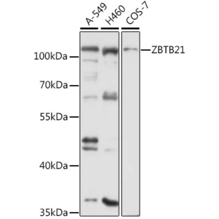 Western Blot - Anti-ZBTB21 Antibody (A12793) - Antibodies.com