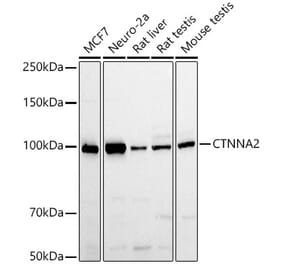 Western Blot - Anti-CTNNA2 Antibody (A88037) - Antibodies.com