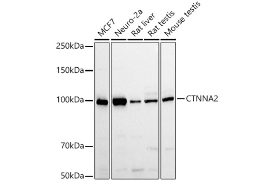 Western Blot - Anti-CTNNA2 Antibody (A88037) - Antibodies.com