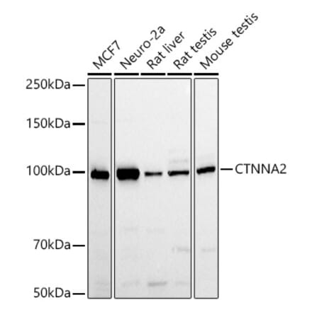 Western Blot - Anti-CTNNA2 Antibody (A88037) - Antibodies.com