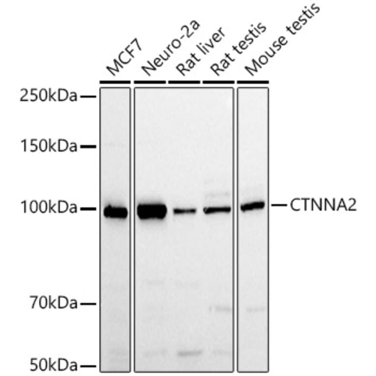 Western Blot - Anti-CTNNA2 Antibody (A88037) - Antibodies.com