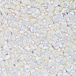 Immunohistochemistry - Anti-CTNNA2 Antibody (A88037) - Antibodies.com