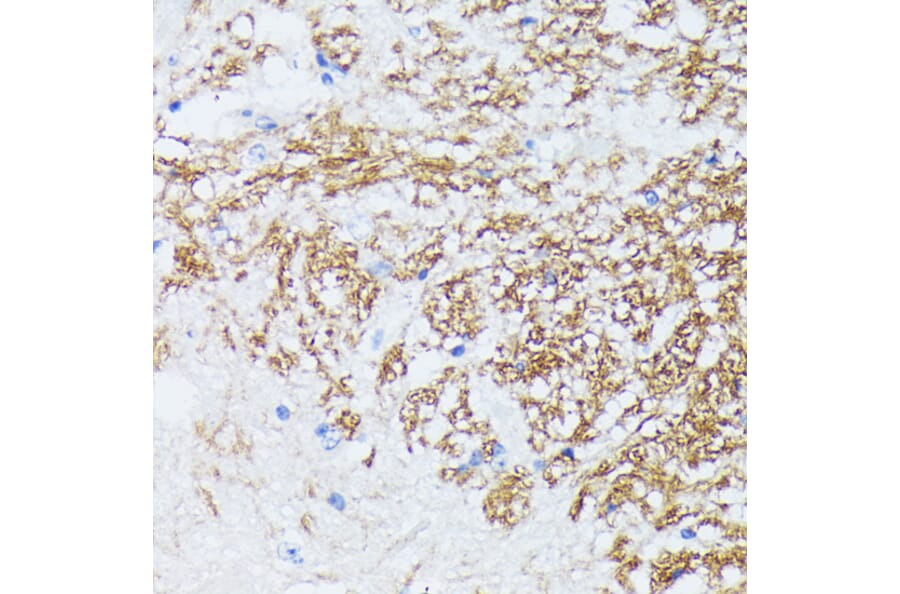 Immunohistochemistry - Anti-CTNNA2 Antibody (A88037) - Antibodies.com