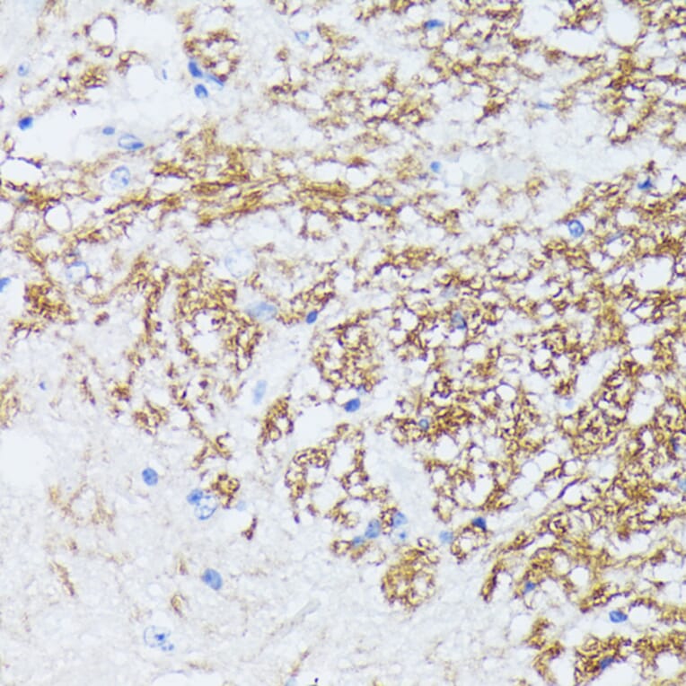 Immunohistochemistry - Anti-CTNNA2 Antibody (A88037) - Antibodies.com