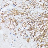 Immunohistochemistry - Anti-CTNNA2 Antibody (A88037) - Antibodies.com