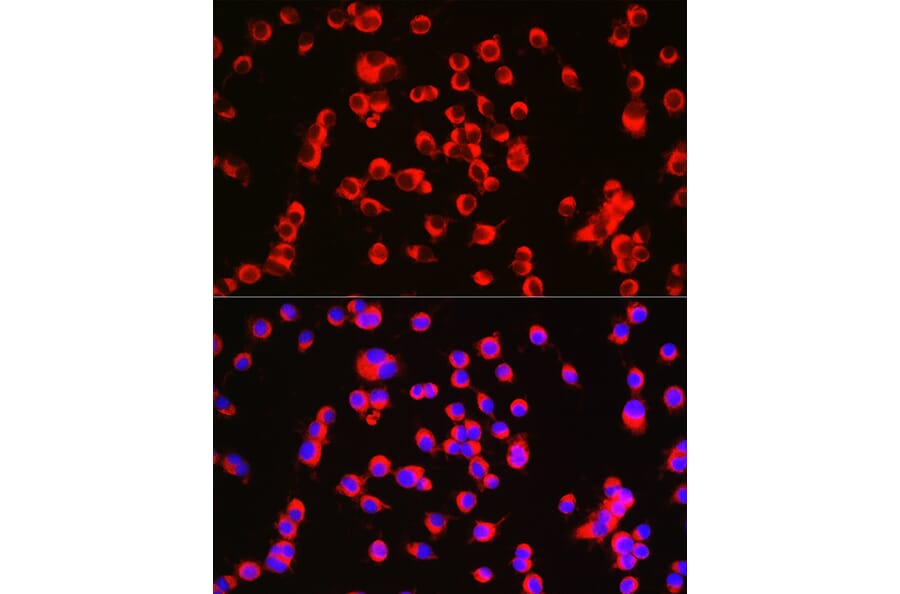 Immunofluorescence - Anti-CTNNA2 Antibody (A88037) - Antibodies.com