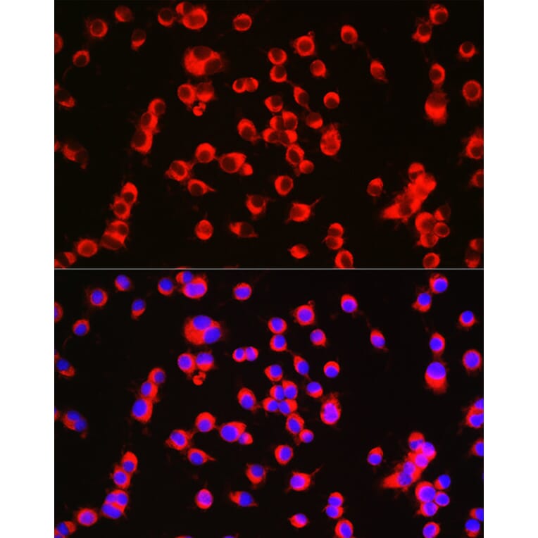 Immunofluorescence - Anti-CTNNA2 Antibody (A88037) - Antibodies.com