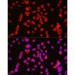 Immunofluorescence - Anti-CTNNA2 Antibody (A88037) - Antibodies.com