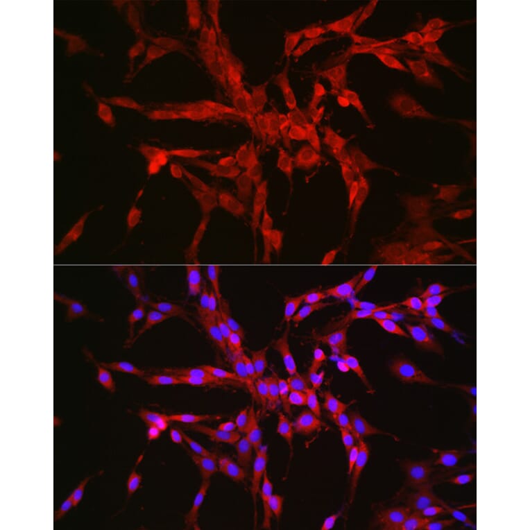 Immunofluorescence - Anti-CTNNA2 Antibody (A88037) - Antibodies.com