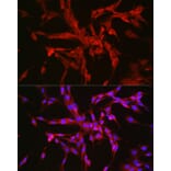 Immunofluorescence - Anti-CTNNA2 Antibody (A88037) - Antibodies.com
