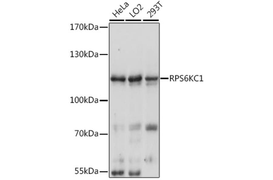 Western Blot - Anti-RPS6KC1 Antibody (A13807) - Antibodies.com