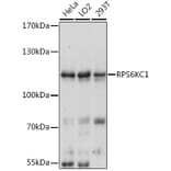 Western Blot - Anti-RPS6KC1 Antibody (A13807) - Antibodies.com