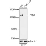 Western Blot - Anti-PMS2 Antibody (A88039) - Antibodies.com