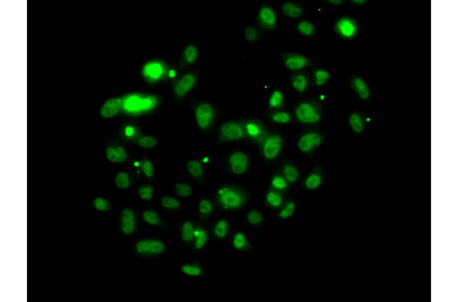 Immunofluorescence - Anti-PMS2 Antibody (A88039) - Antibodies.com