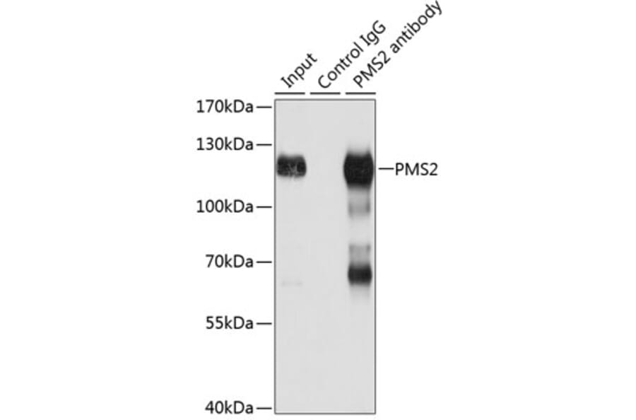 Western Blot - Anti-PMS2 Antibody (A88039) - Antibodies.com