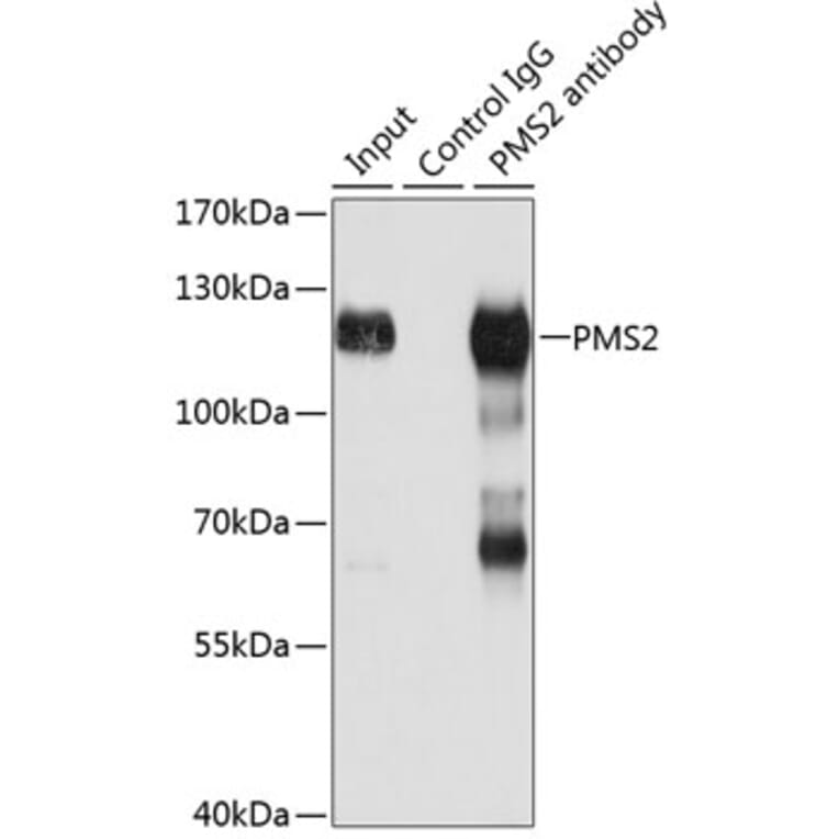 Western Blot - Anti-PMS2 Antibody (A88039) - Antibodies.com