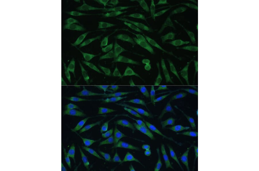 Immunofluorescence - Anti-Dynamin 3 Antibody (A88040) - Antibodies.com