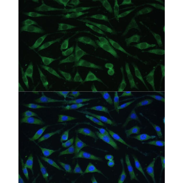 Immunofluorescence - Anti-Dynamin 3 Antibody (A88040) - Antibodies.com