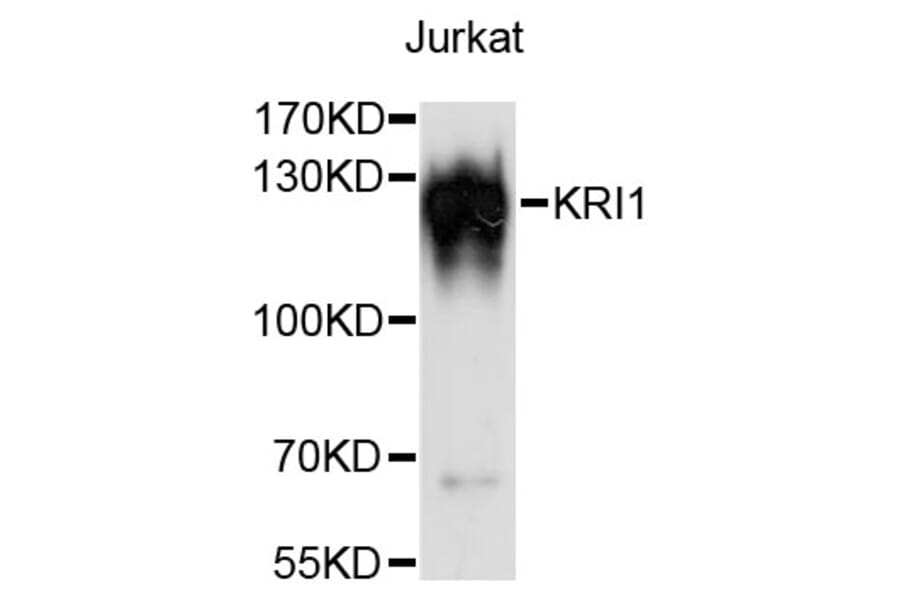 Western Blot - Anti-KRI1 Antibody (A13881) - Antibodies.com