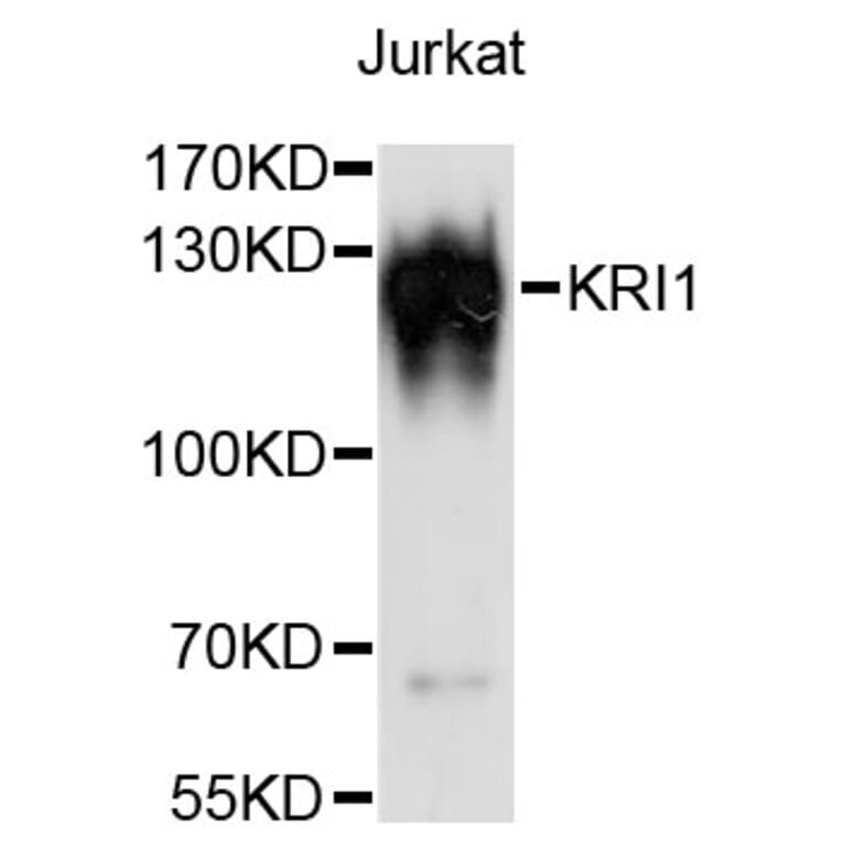 Western Blot - Anti-KRI1 Antibody (A13881) - Antibodies.com