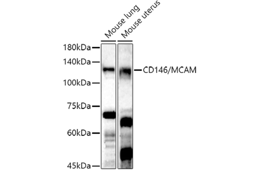 Western Blot - Anti-CD146 Antibody (A88042) - Antibodies.com