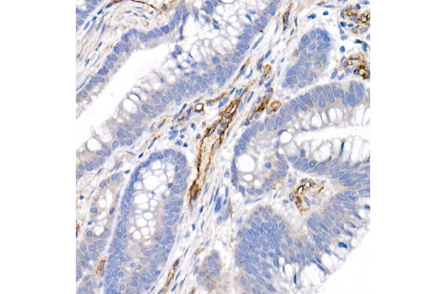 Immunohistochemistry - Anti-CD146 Antibody (A88042) - Antibodies.com