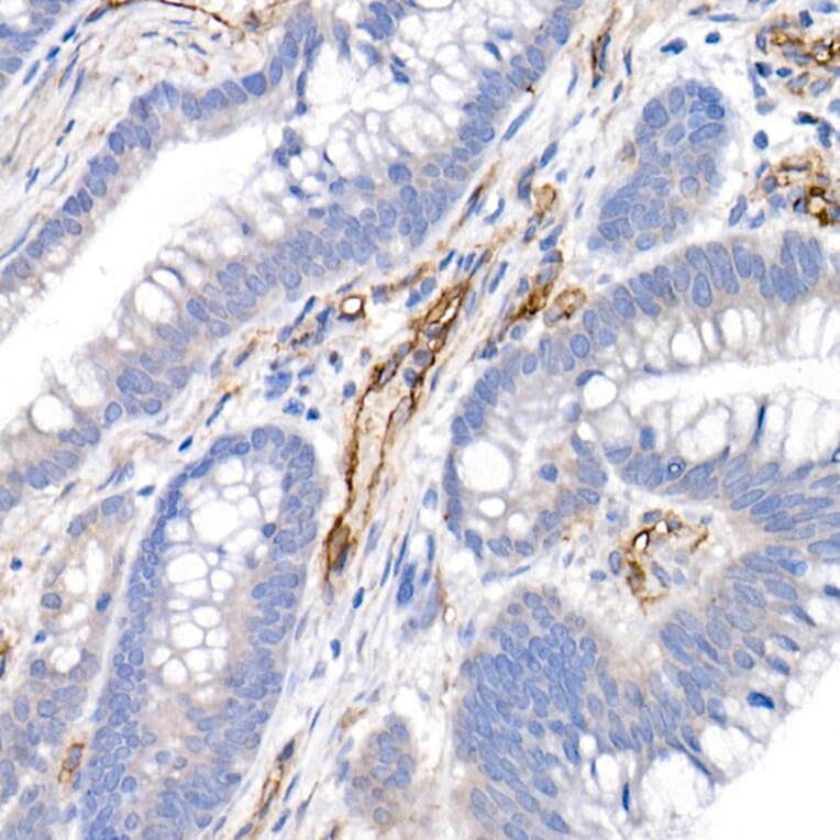 Immunohistochemistry - Anti-CD146 Antibody (A88042) - Antibodies.com