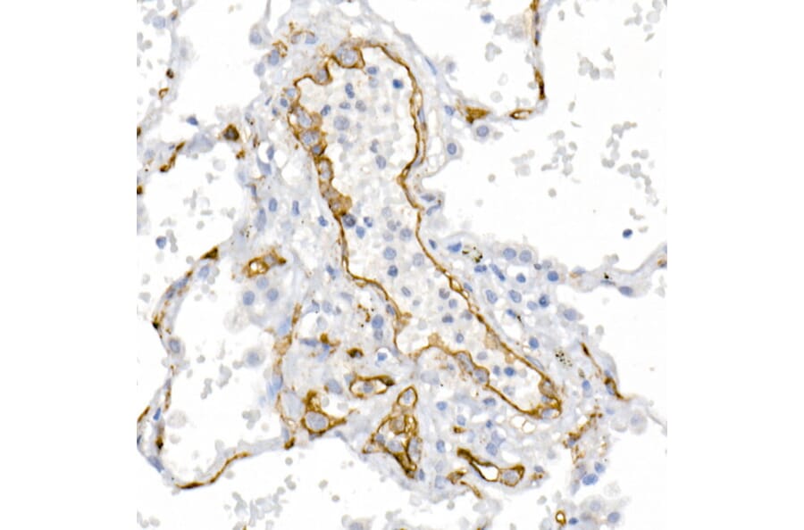 Immunohistochemistry - Anti-CD146 Antibody (A88042) - Antibodies.com