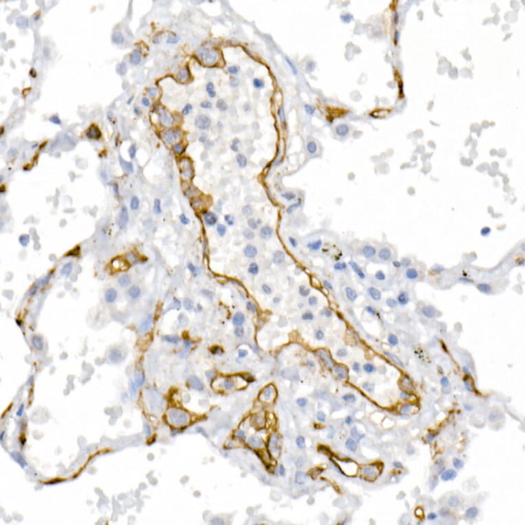 Immunohistochemistry - Anti-CD146 Antibody (A88042) - Antibodies.com