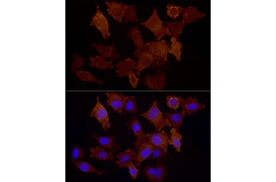 Immunofluorescence - Anti-CD146 Antibody (A88042) - Antibodies.com