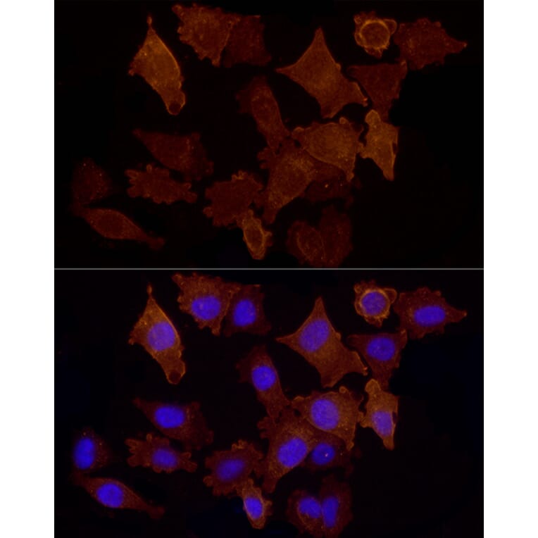 Immunofluorescence - Anti-CD146 Antibody (A88042) - Antibodies.com