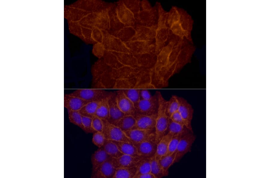 Immunofluorescence - Anti-CD146 Antibody (A88042) - Antibodies.com