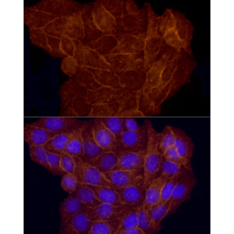 Immunofluorescence - Anti-CD146 Antibody (A88042) - Antibodies.com