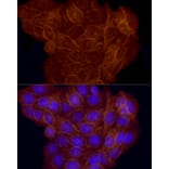 Immunofluorescence - Anti-CD146 Antibody (A88042) - Antibodies.com