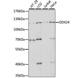 Western Blot - Anti-DDX24 Antibody (A88044) - Antibodies.com
