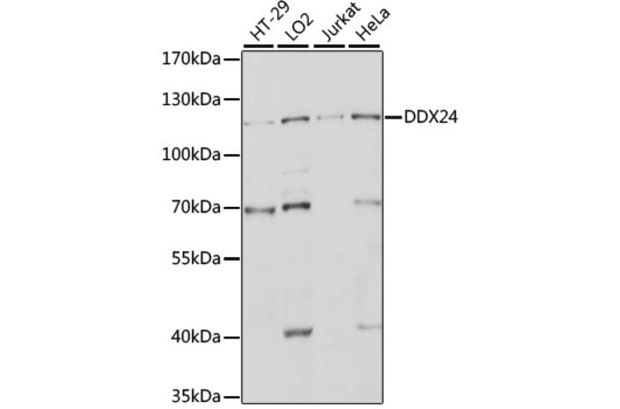 Western Blot - Anti-DDX24 Antibody (A88044) - Antibodies.com